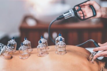 A Verdade que as Marcas de Lâminas não Contam 🤫✂️