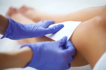 🧠💆‍♀️ Ventosaterapia e Saúde Mental e Emocional: equilíbrio para viver com mais leveza