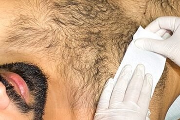 🧘‍♂️ Ventosaterapia e Bem-Estar Mental: combatendo o estresse, a ansiedade e a insônia ✨